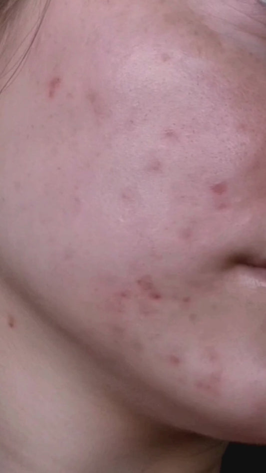 ✨ Sérum Apaisant et Hydratant au Thé Vert ; Armoise